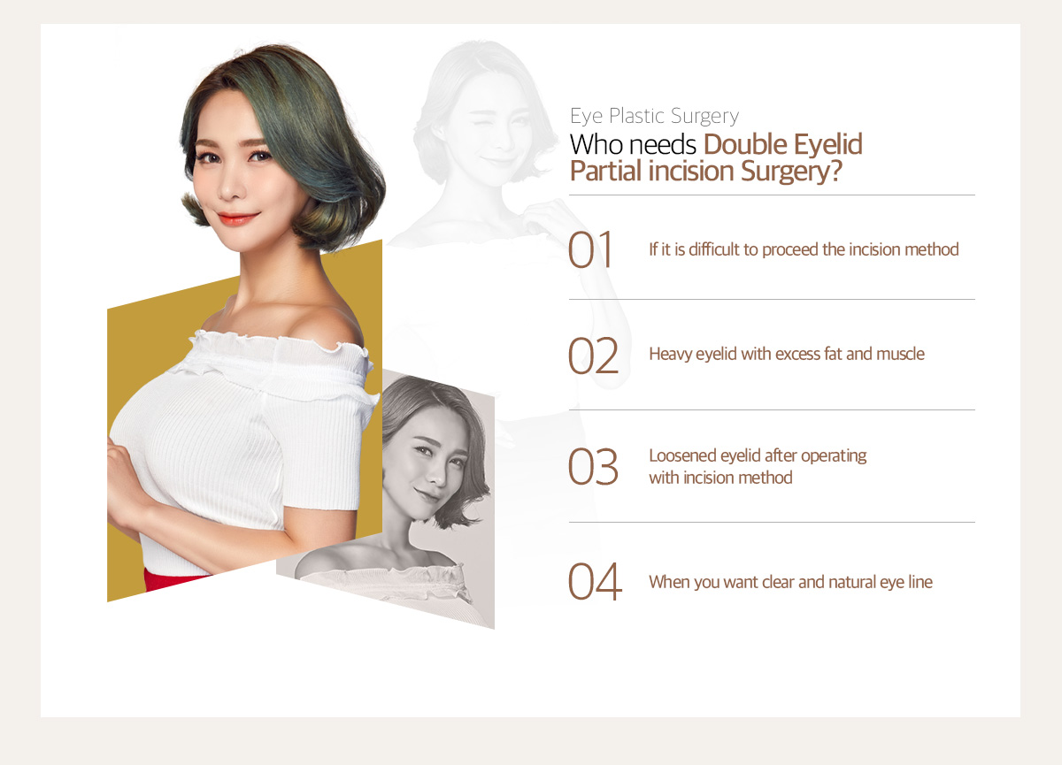 Who need partial incision double eyelid surgery?